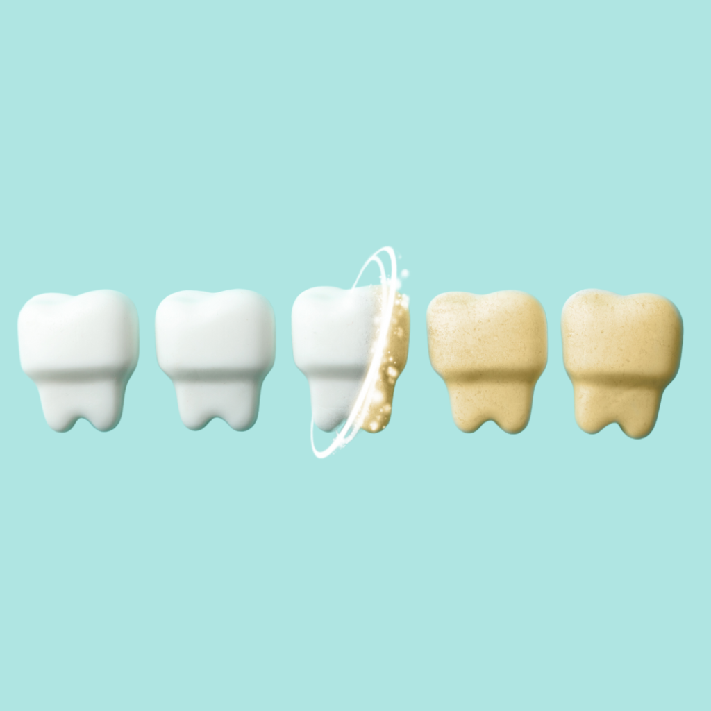 Teeth whitening Family Dentist in Penrith
